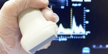 Doppler Transcraniano