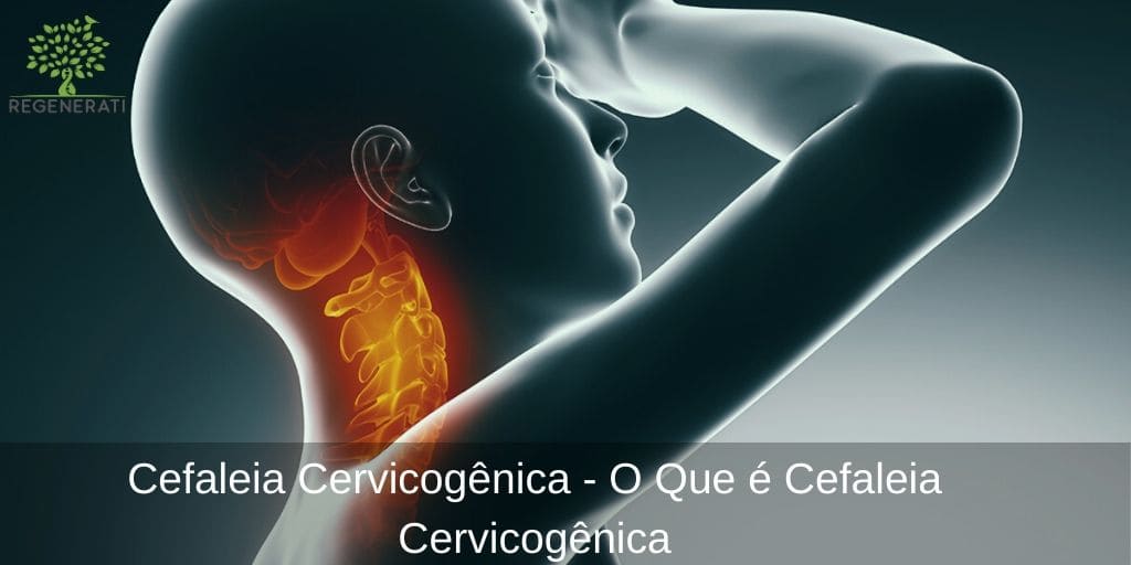 Cefaleia Cervicogênica - O Que é Cefaleia Cervicogênica