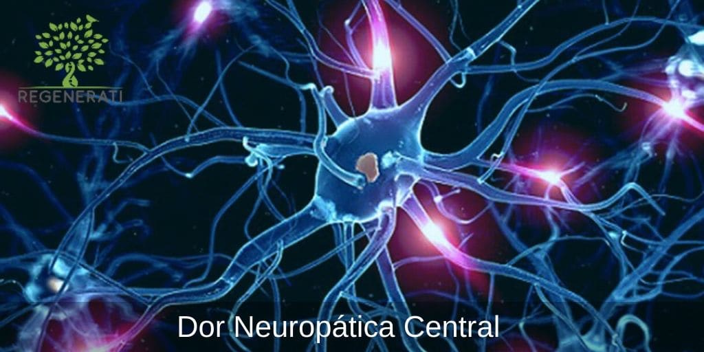 Dor Neuropática Central