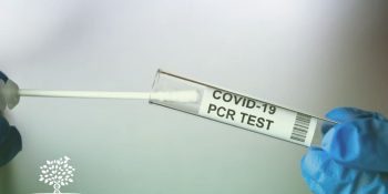 Teste PCR e COVID-19 – Indicação para Pessoas em Contato de Infectados pela COVID-19