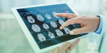 Estimulação Magnética Transcraniana (EMT) para Tratamento de Dor Crônica