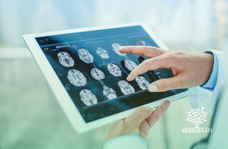 Estimulação Magnética Transcraniana (EMT) para Tratamento de Dor Crônica